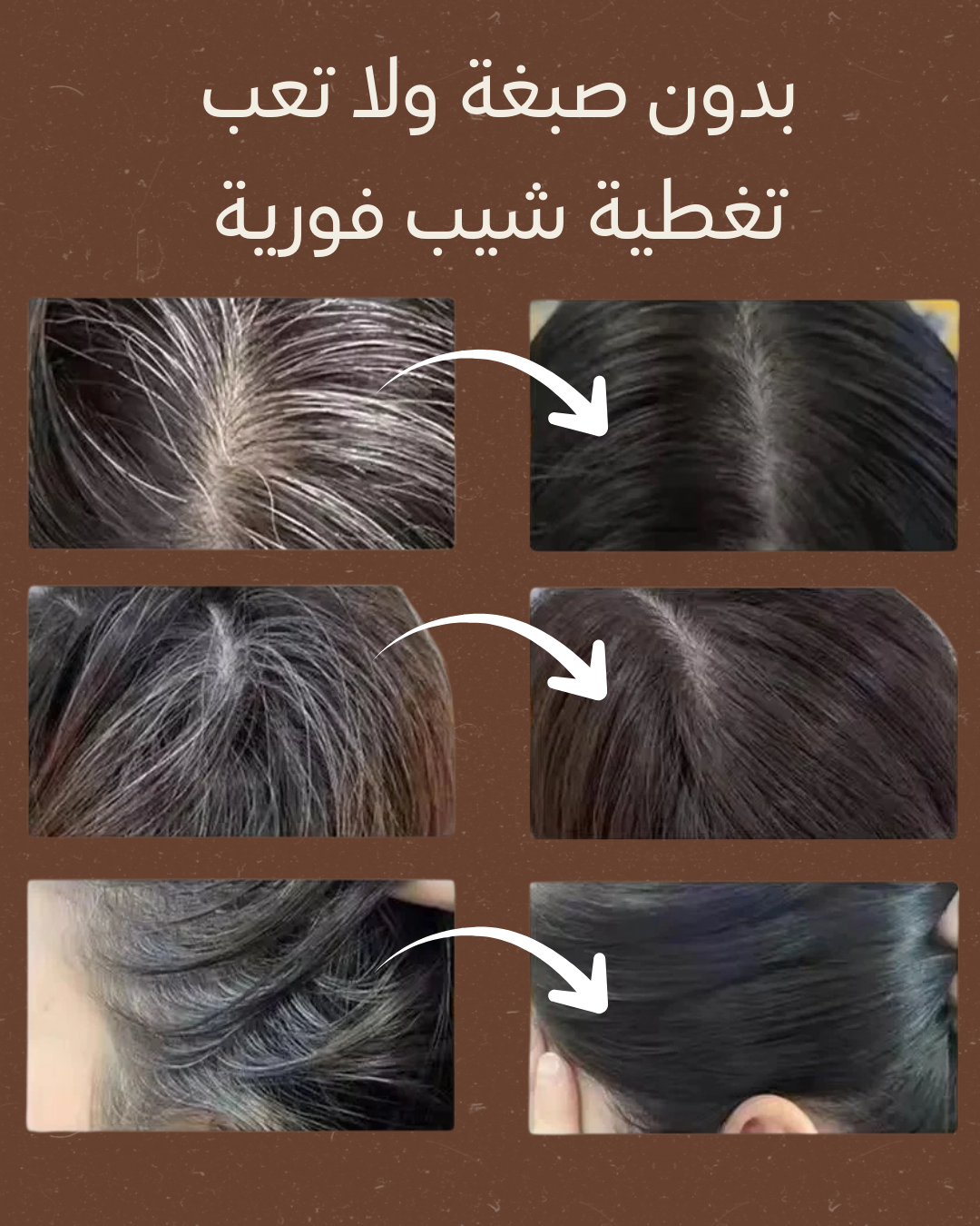 مشط الشيب للرصيد